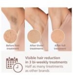 Philips Lumea Prestige BRI949/00 IPL Hair Removal Device