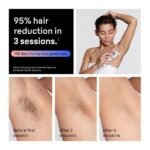 Braun Skin i-expert Pro 7 PL7441 IPL Hair Removal Device - Image 4